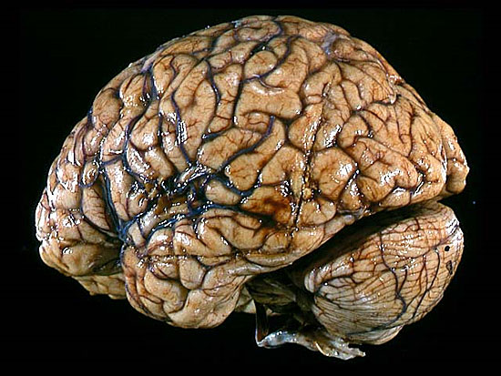 Количество извилин в мозгу никак не связано с наличием ума