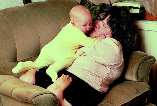«Талидомидные дети» — люди, родившиеся с уродствами из-за приёма их матерями талидомида