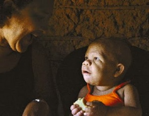 В Бразилии живёт девушка, которая в 30 лет физически и умственно развита на 9 месяцев