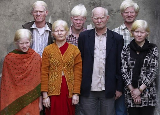 Самая большая в мире семья альбиносов насчитывает 10 человек