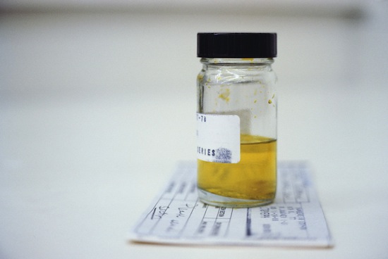 10 unexpected facts about the urine