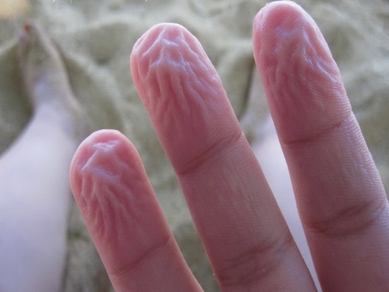 Пальцы сморщиваются при длительном контакте с водой для того, чтобы лучше удерживать мокрые и скользкие предметы