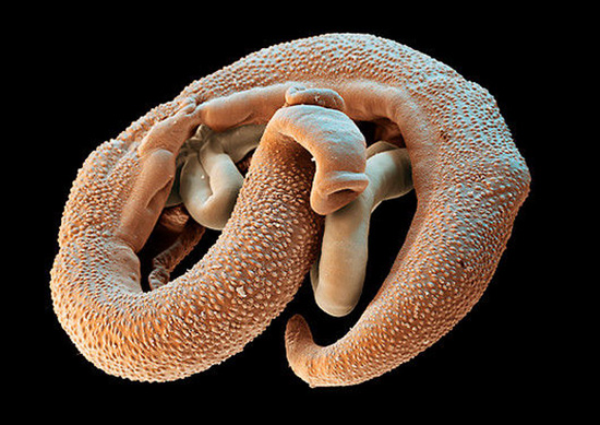 Паразитические черви шистосомы могут жить в теле человека десятилетиями