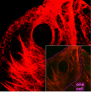 Микроскопическое изображение нитей кератина внутри клетки