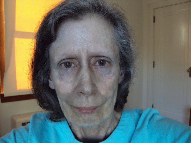 Женщина 60 лет прожила с серебряной кожей