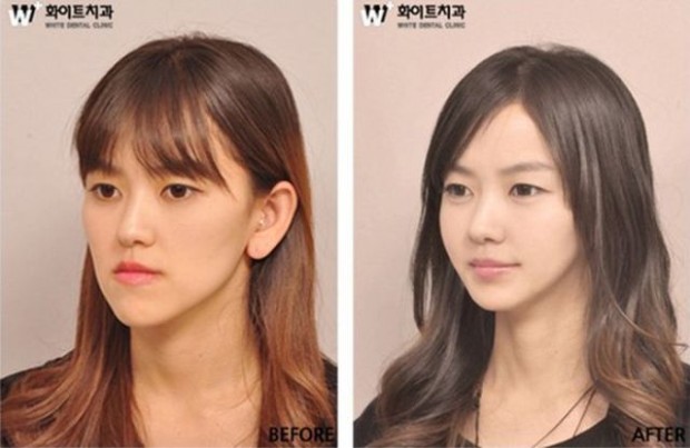 В Южной Корее пластические хирурги меняют лица пациентов до полной неузнаваемости
