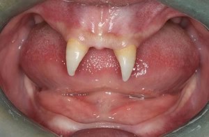 10 случаев неестественного расположения зубов