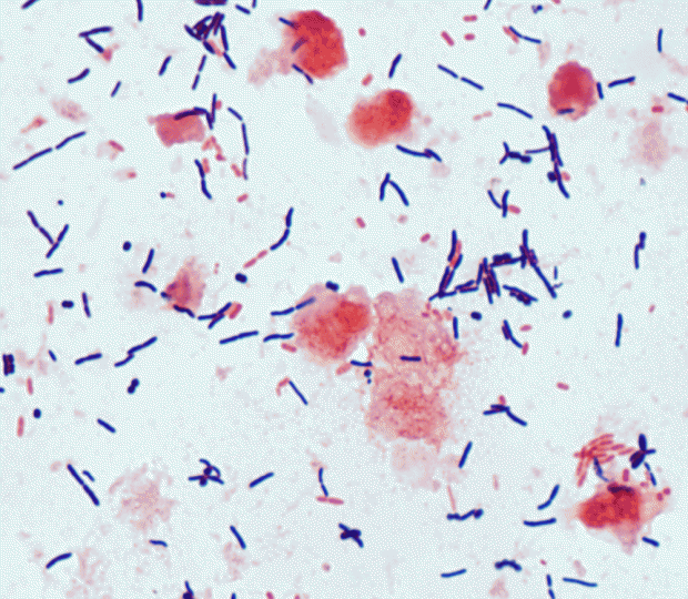 Clostridium difficile / © depts.washington.edu