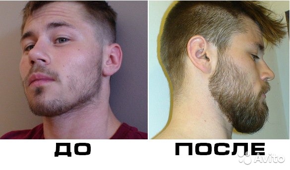 Как сделать что-бы выросла щетина Как сделать что-бы выросла щетина