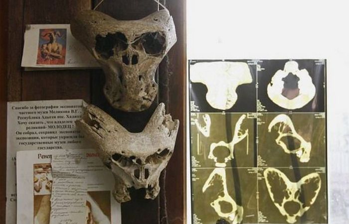 Рентген черепов