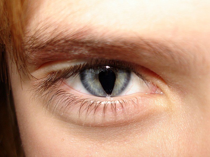 У некоторых людей зрачки глаз похожи на замочные скважины.