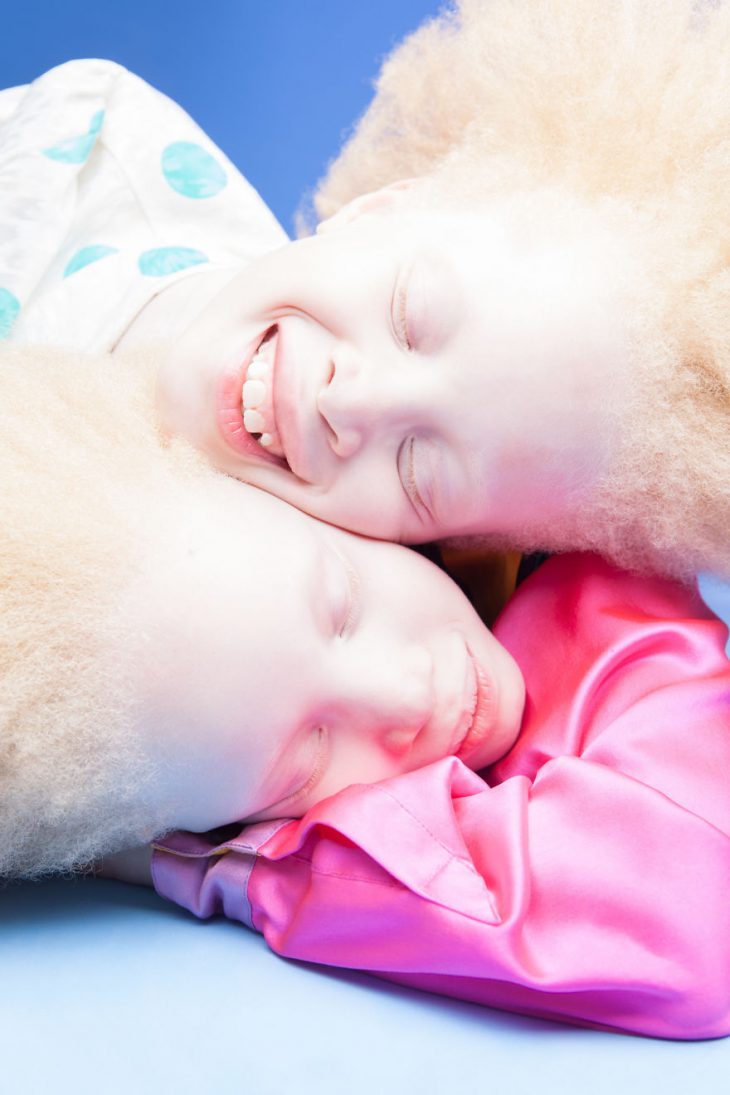 Близнецы альбиносы из Бразилии покорили мир моды своей странной внешностью