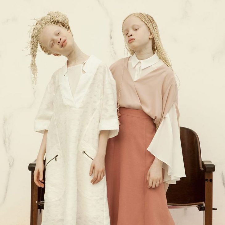 Близнецы альбиносы из Бразилии покорили мир моды своей странной внешностью