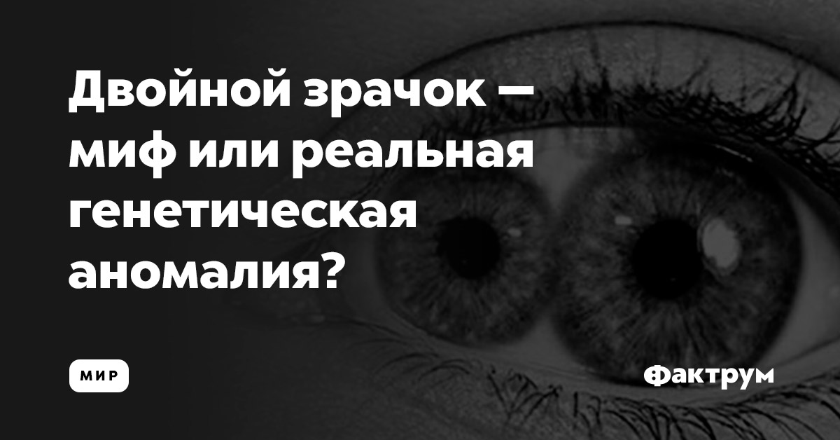 Двойной зрачок — миф или реальная генетическая аномалия?