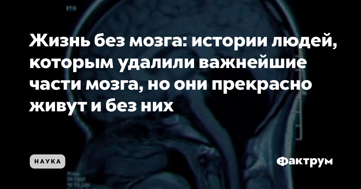 Акпп без мозгов