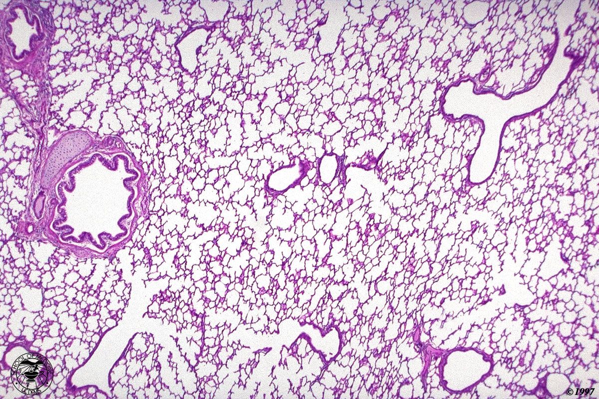 Какая ткань в легких. Альвеолы гистология препарат. Легочная ткань микропрепарат. Терминальная бронхиола гистология. Респираторная альвеола гистология.