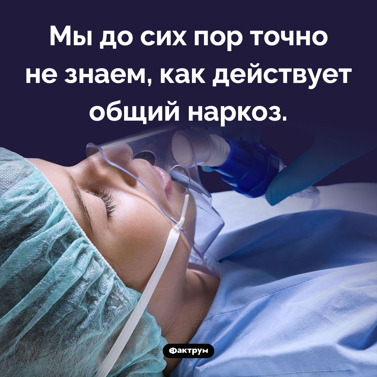 Общий наркоз