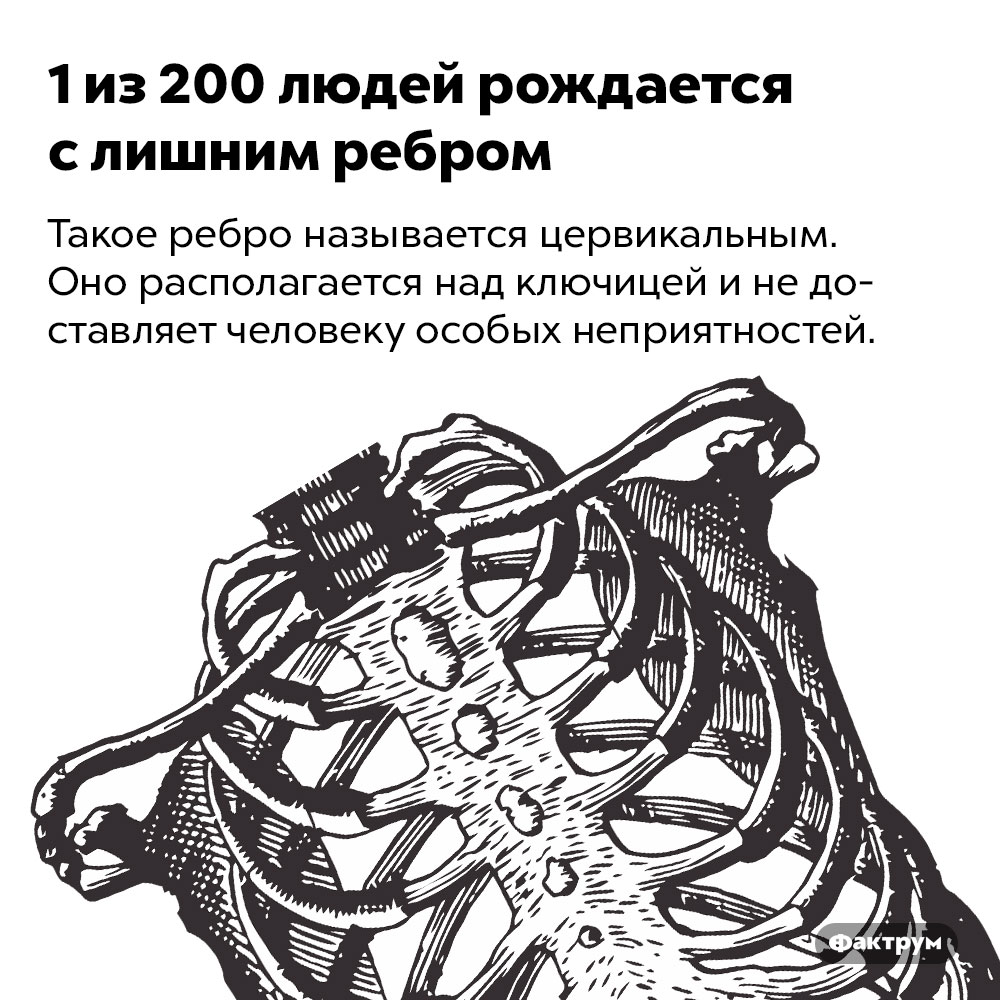 1 из 200 людей рождается с лишним ребром. Такое ребро называется цервикальным. Оно располагается над ключицей и не доставляет человеку особых неприятностей.
