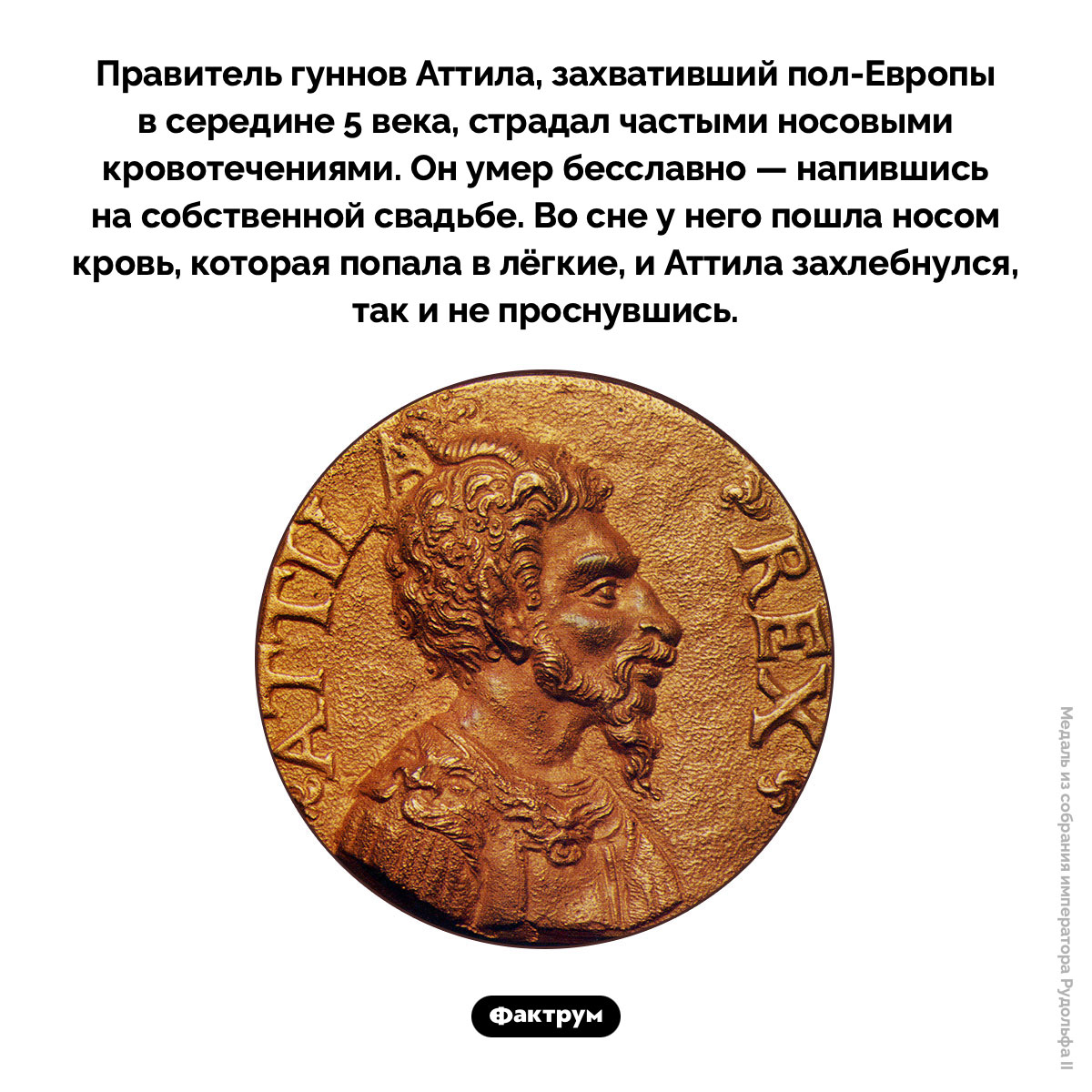 Гунн Аттила умер от кровотечения из носа. Правитель гуннов Аттила, захвативший пол-Европы в середине 5 века, страдал частыми носовыми кровотечениями. Он умер бесславно — напившись на собственной свадьбе. Во сне у него пошла носом кровь, которая попала в лёгкие, и Аттила захлебнулся, так и не проснувшись.