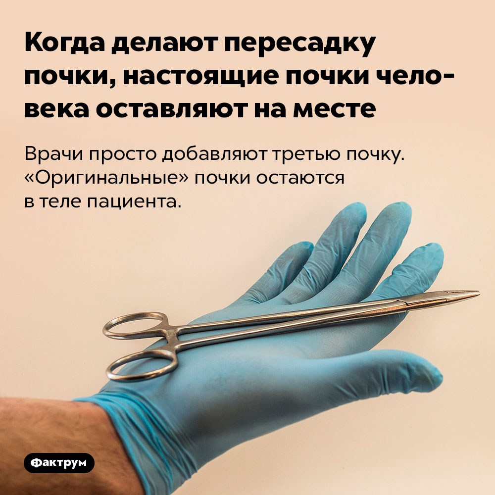 Операция По Пересадке Почки Стоимость
