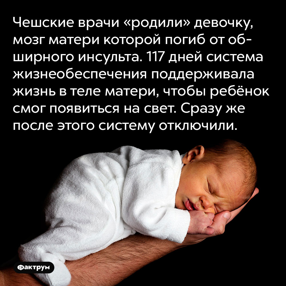 Чешские врачи «родили» девочку, мозг матери которой погиб от обширного инсульта. 117 дней система жизнеобеспечения поддерживала жизнь в теле матери, чтобы ребёнок смог появиться на свет. Сразу же после этого систему отключили.