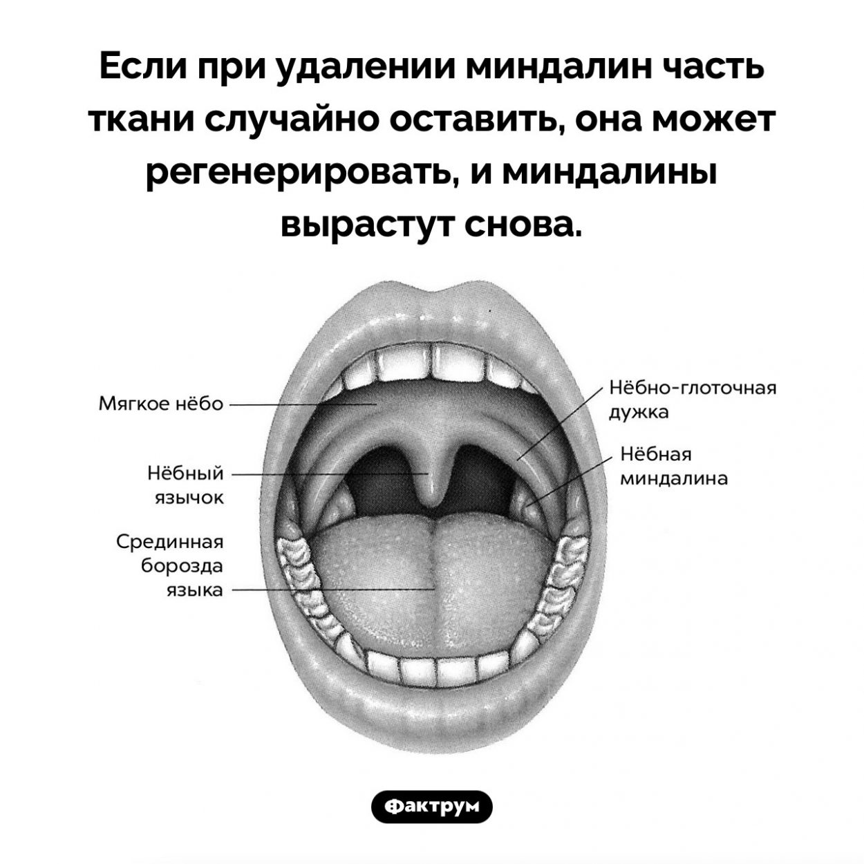 Миндалины могут регенерировать. Если при удалении миндалин часть ткани случайно оставить, она может регенерировать, и миндалины вырастут снова.