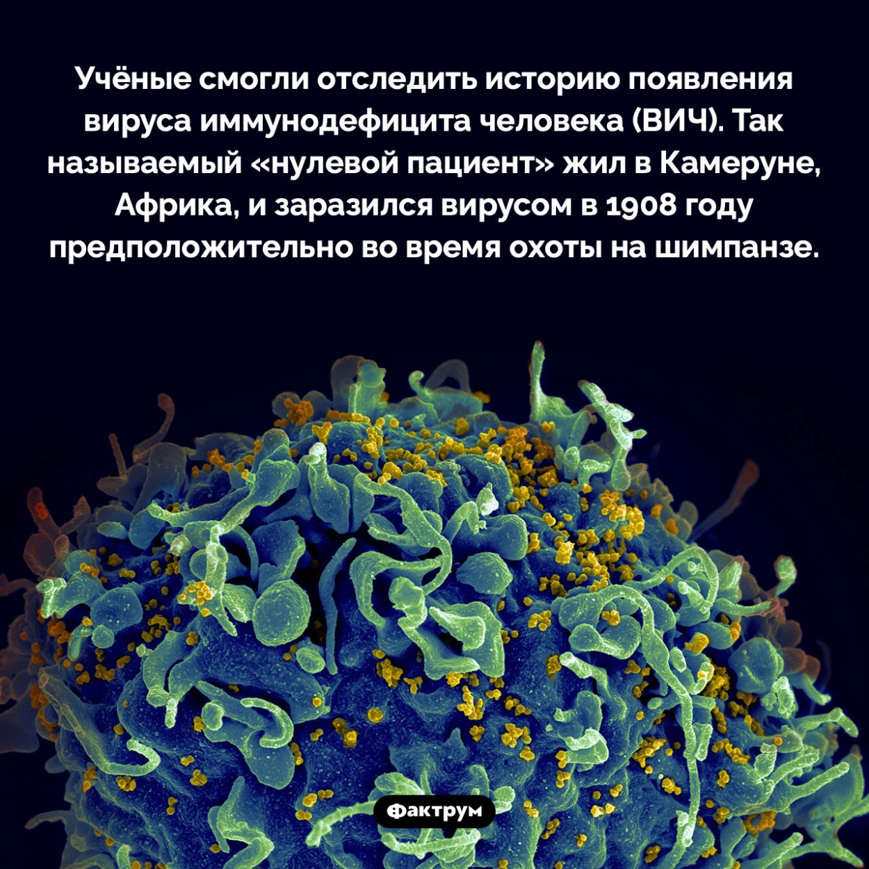 Нулевой пациент вируса иммунодефицита. Учёные смогли отследить историю появления вируса иммунодефицита человека (ВИЧ). Так называемый «нулевой пациент» жил в Камеруне, Африка, и заразился вирусом в 1908 году предположительно во время охоты на шимпанзе.