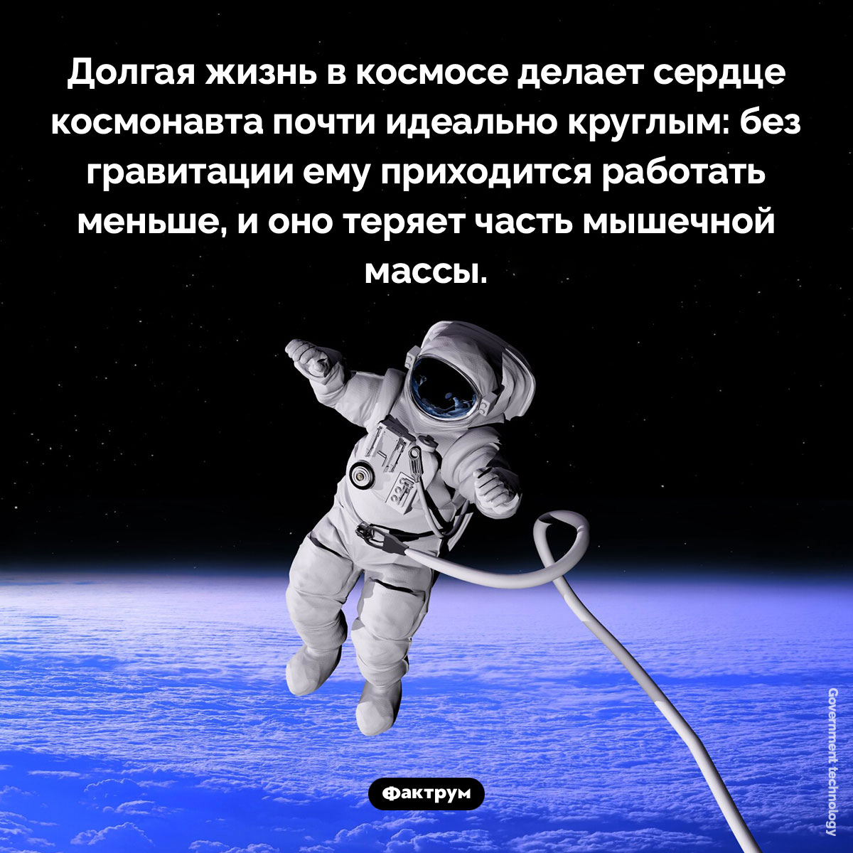 Сердце в космосе. Долгая жизнь в космосе делает сердце космонавта почти идеально круглым: без гравитации ему приходится работать меньше, и оно теряет часть мышечной массы.
