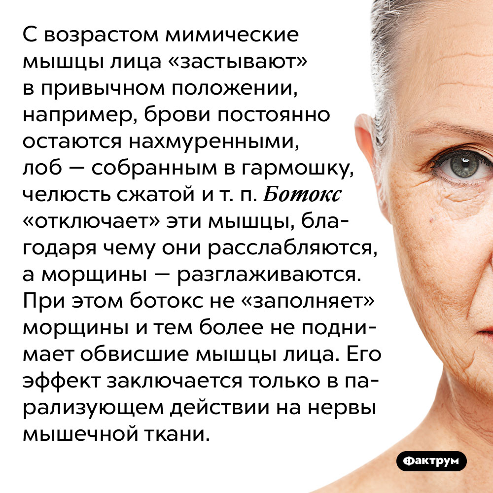 Как работает ботокс. С возрастом мимические мышцы лица «застывают» в привычном положении, например, брови постоянно остаются нахмуренными, лоб — собранным в гармошку, челюсть сжатой и т. п. Ботокс «отключает» эти мышцы, благодаря чему они расслабляются, а морщины — разглаживаются. При этом ботокс не «заполняет» морщины и тем более не поднимает обвисшие мышцы лица. Его эффект заключается только в парализующем действии на нервы мышечной ткани.