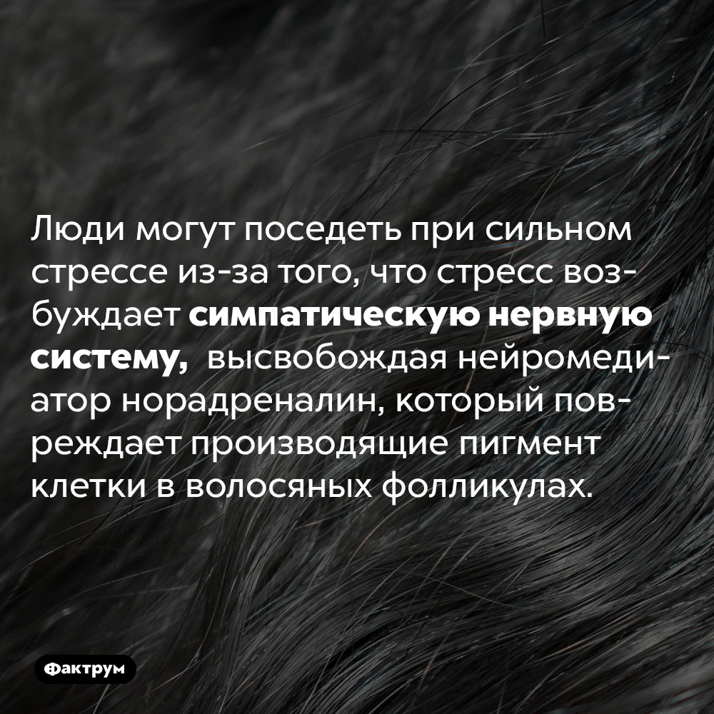 Почему люди седеют от стресса. Люди могут поседеть при сильном стрессе из-за того, что стресс возбуждает симпатическую нервную систему,  высвобождая нейромедиатор норадреналин, который повреждает производящие пигмент клетки в волосяных фолликулах.