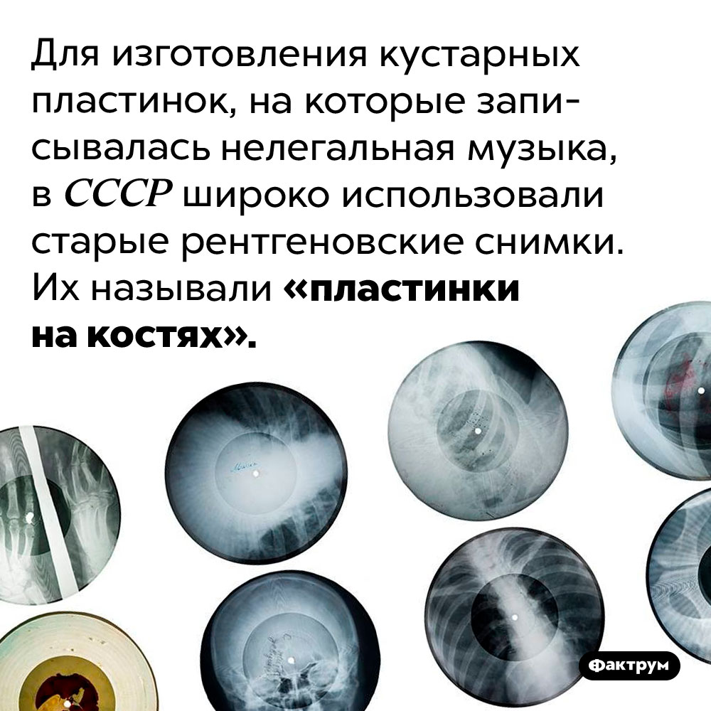 Что такое «пластинки на костях». Для изготовления кустарных пластинок, на которые записывалась нелегальная музыка, в СССР широко использовали старые рентгеновские снимки. Их называли «пластинки на костях».