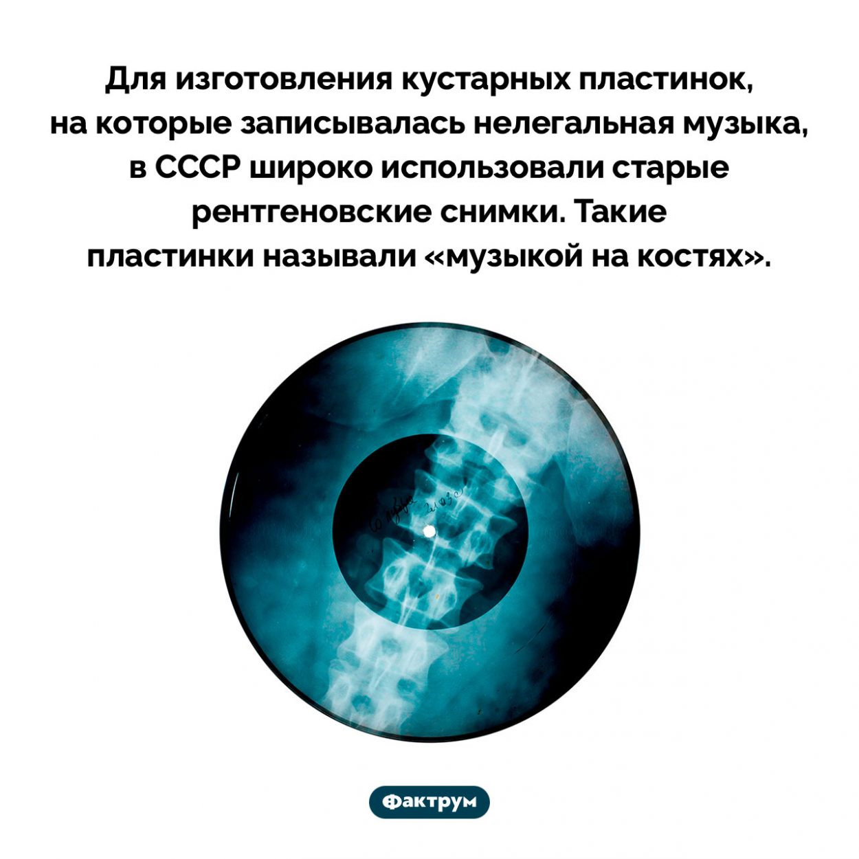 Что такое «музыка на костях». Для изготовления кустарных пластинок, на которые записывалась нелегальная музыка, в СССР широко использовали старые рентгеновские снимки. Такие пластинки называли «музыкой на костях».