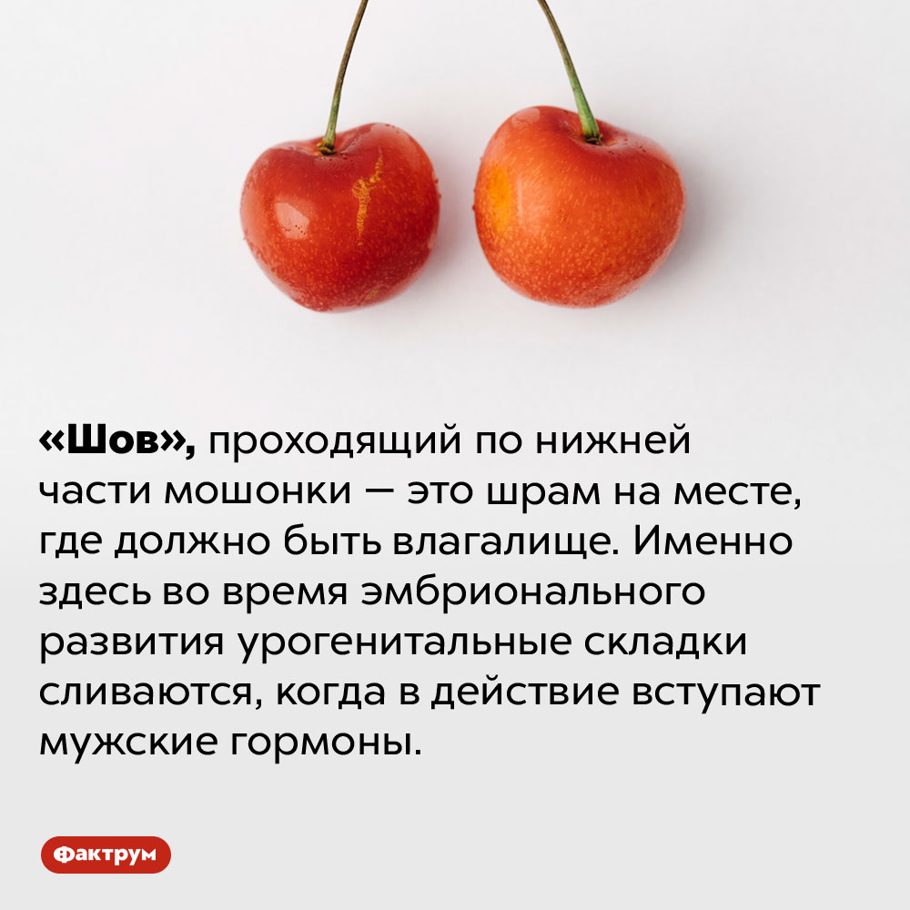 Что такое «шов промежности». «Шов», проходящий по нижней части мошонки — это шрам на месте, где должно быть влагалище. Именно здесь во время эмбрионального развития урогенитальные складки сливаются, когда в действие вступают мужские гормоны.