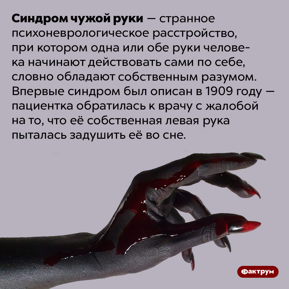 Синдром чужой руки может заставить вашу руку попытаться убить вас. Синдром чужой руки — странное психоневрологическое расстройство, при котором одна или обе руки человека начинают действовать сами по себе, словно обладают собственным разумом. Впервые синдром был описан в 1909 году — пациентка обратилась к врачу с жалобой на то, что её собственная левая рука пыталась задушить её во сне.