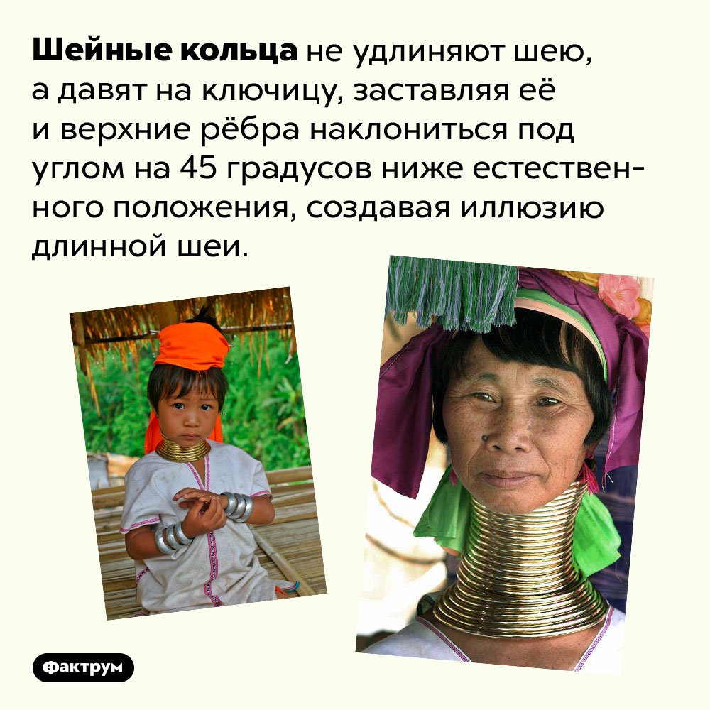 Шейные кольца не удлиняют шею, а оттягивают ключицу. Шейные кольца не удлиняют шею, а давят на ключицу, заставляя её и верхние рёбра наклониться под углом на 45 градусов ниже естественного положения, создавая иллюзию длинной шеи.