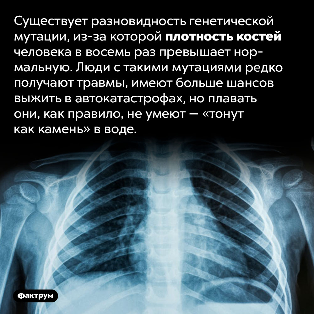 Существуют «неуязвимые» люди со сверхплотными костями. Существует разновидность генетической мутации, из-за которой плотность костей человека в восемь раз превышает нормальную. Люди с такими мутациями редко получают травмы, имеют больше шансов выжить в автокатастрофах, но плавать они, как правило, не умеют — «тонут как камень» в воде.