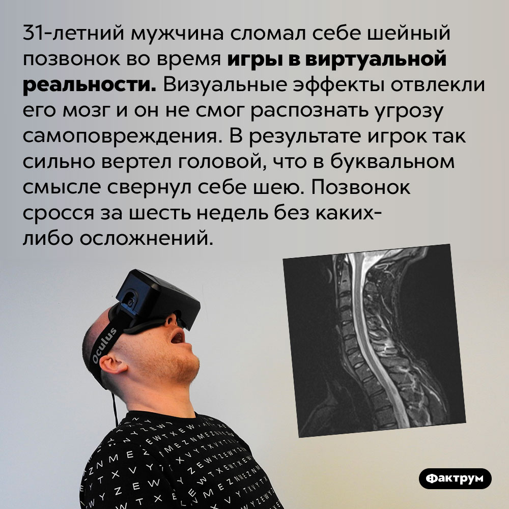 VR-игры могут свернуть вам шею. 31-летний мужчина сломал себе шейный позвонок во время игры в виртуальной реальности. Визуальные эффекты отвлекли его мозг и он не смог распознать угрозу самоповреждения. В результате игрок так сильно вертел головой, что в буквальном смысле свернул себе шею. Позвонок сросся за шесть недель без каких-либо осложнений.