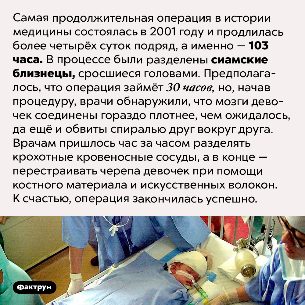 Какова продолжительность жизни человека с Аллодиния?