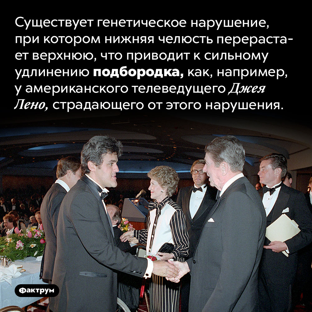 Почему у некоторых людей очень длинный подбородок. Существует генетическое нарушение, при котором нижняя челюсть перерастает верхнюю, что приводит к сильному удлинению подбородка, как, например, у американского телеведущего Джея Лено, страдающего от этого нарушения.