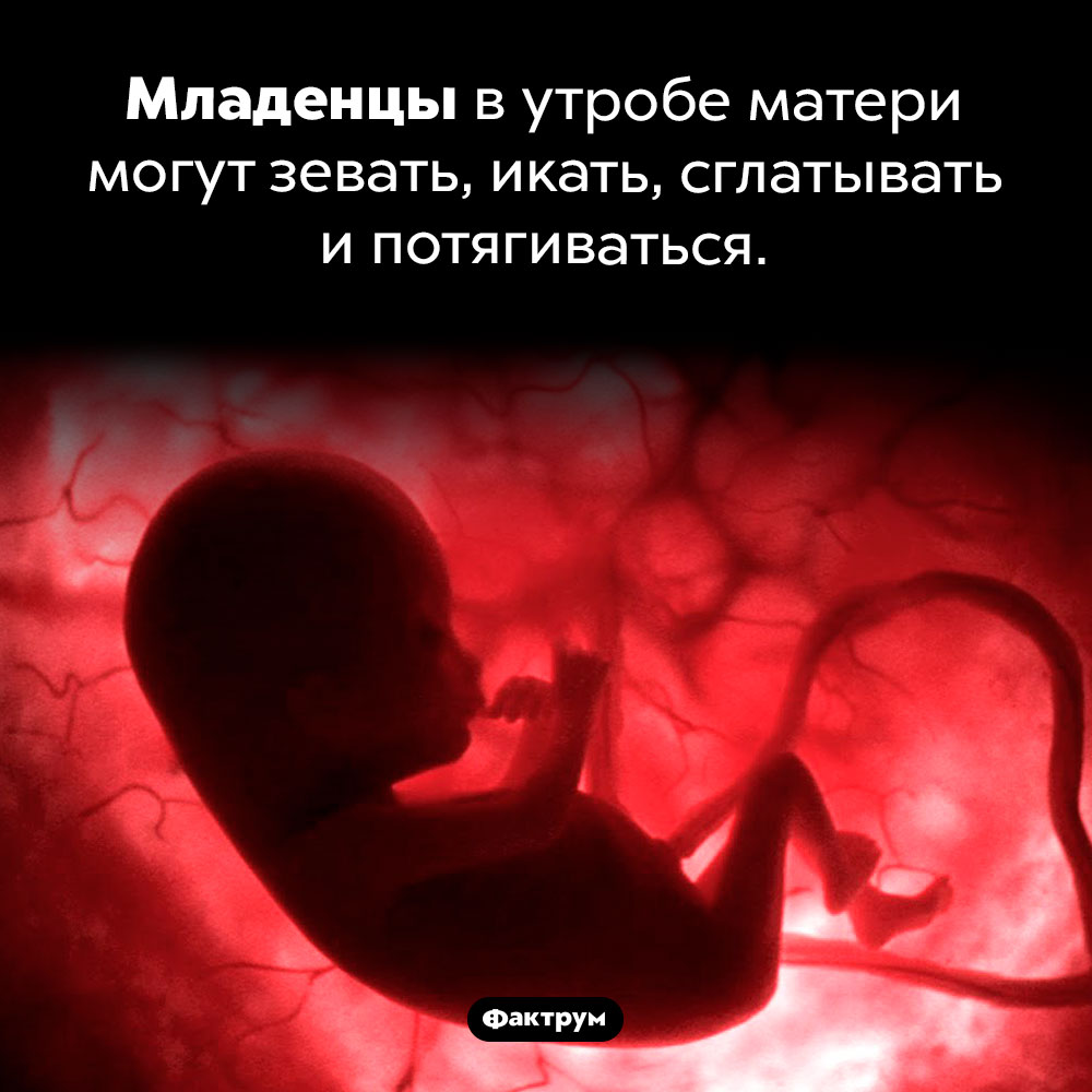 Удивительные способности еще не родившихся детей. Младенцы в утробе матери могут зевать, икать, сглатывать и потягиваться.