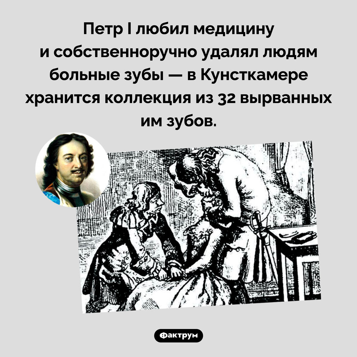 Петр I и стоматология. Петр I любил медицину и собственноручно удалял людям больные зубы — в Кунсткамере хранится коллекция из 32 вырванных им зубов.