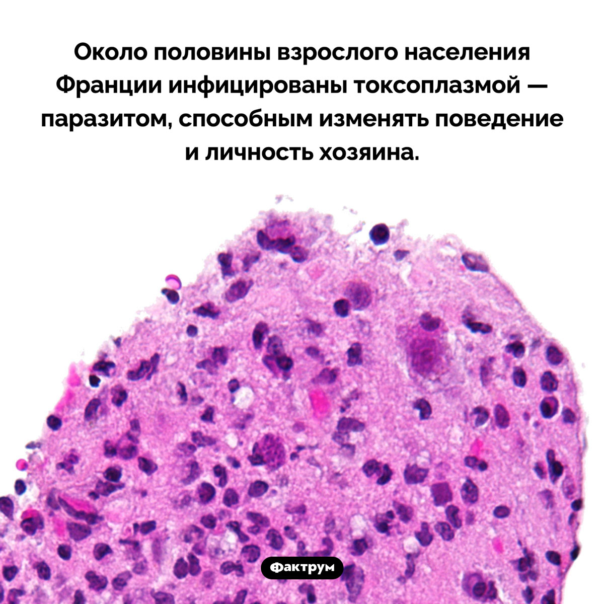 Французы и токсоплазмоз. <p>Около половины взрослого населения Франции инфицированы токсоплазмой — паразитом, способным изменять поведение и личность хозяина.</p>