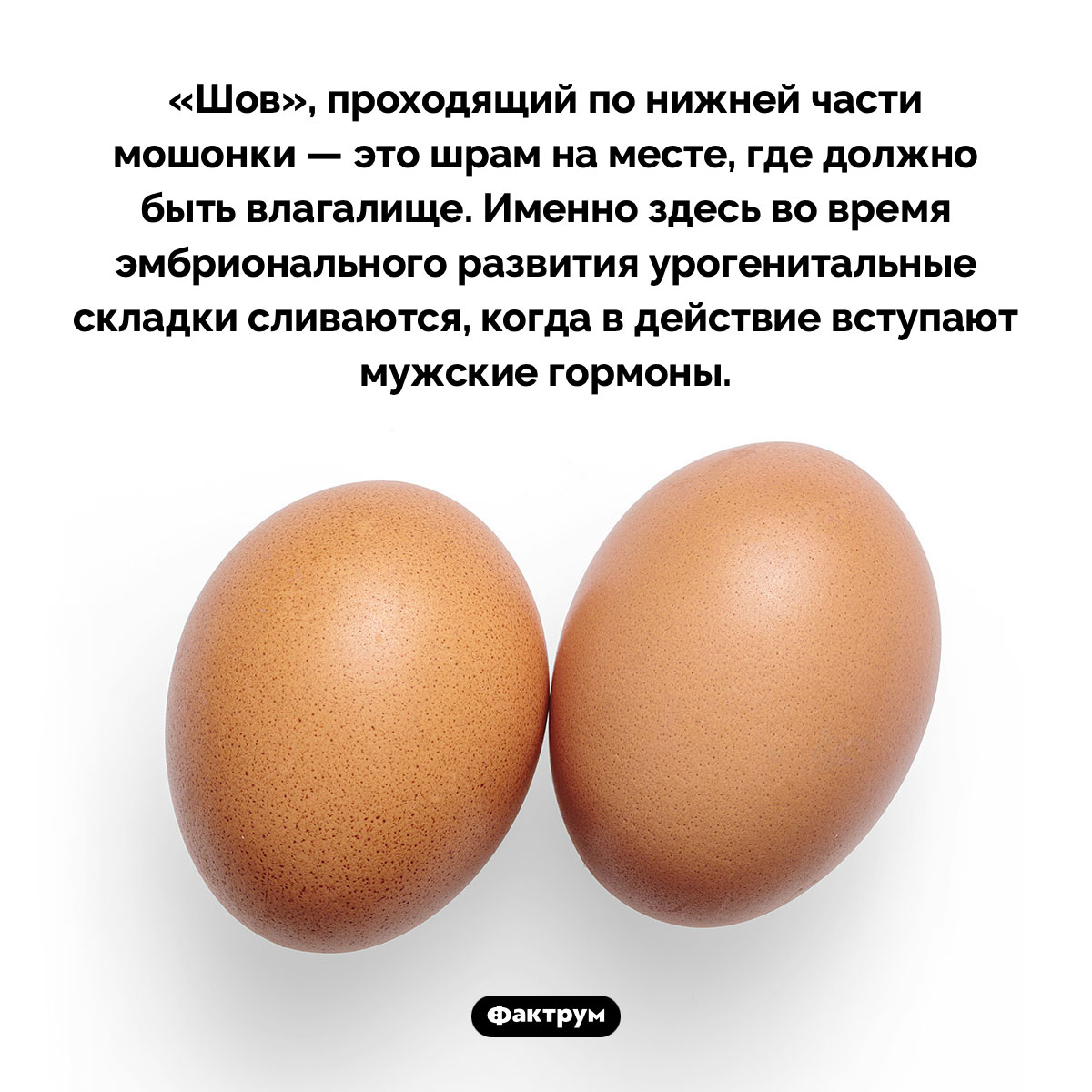 Что такое «шов промежности». «Шов», проходящий по нижней части мошонки — это шрам на месте, где должно быть влагалище. Именно здесь во время эмбрионального развития урогенитальные складки сливаются, когда в действие вступают мужские гормоны.