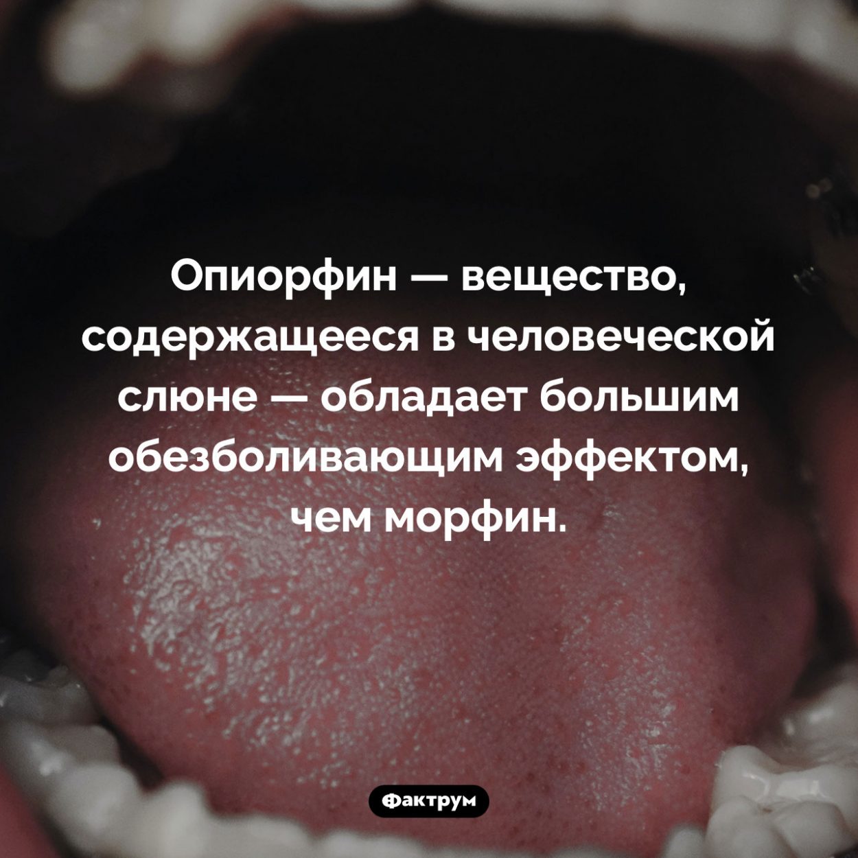 Что такое «опиорфин». Опиорфин — вещество, содержащееся в человеческой слюне — обладает большим обезболивающим эффектом, чем морфин.