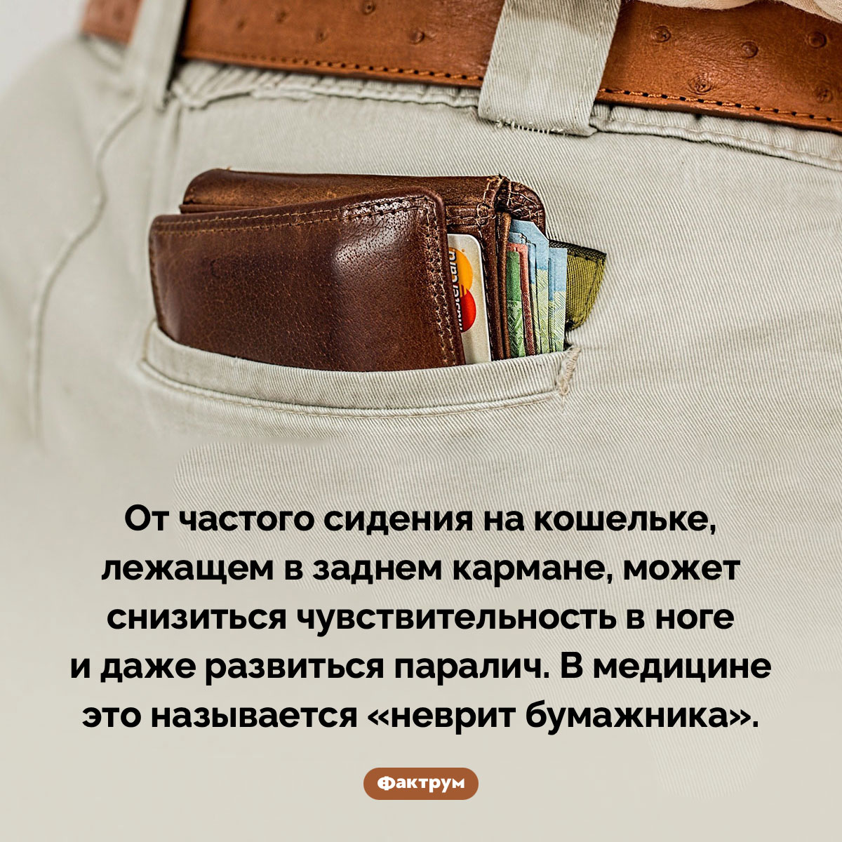 Неврит бумажника. От частого сидения на кошельке, лежащем в заднем кармане, может снизиться чувствительность в ноге и даже развиться паралич. В медицине это называется «неврит бумажника».