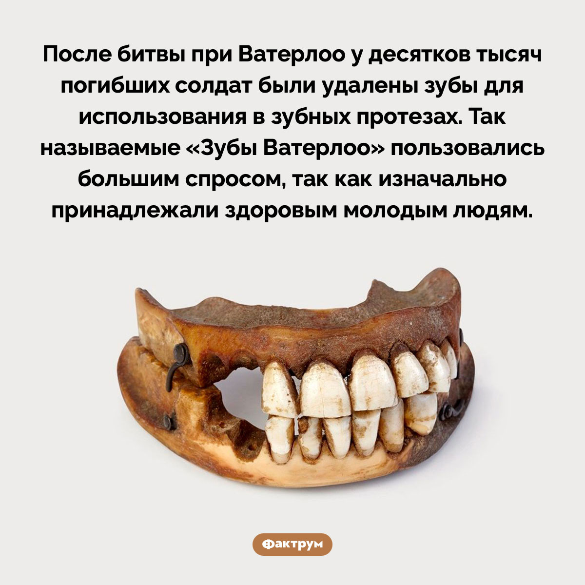 «Зубы Ватерлоо». После битвы при Ватерлоо у десятков тысяч погибших солдат были удалены зубы для использования в зубных протезах. Так называемые «Зубы Ватерлоо» пользовались большим спросом, так как изначально принадлежали здоровым молодым людям.