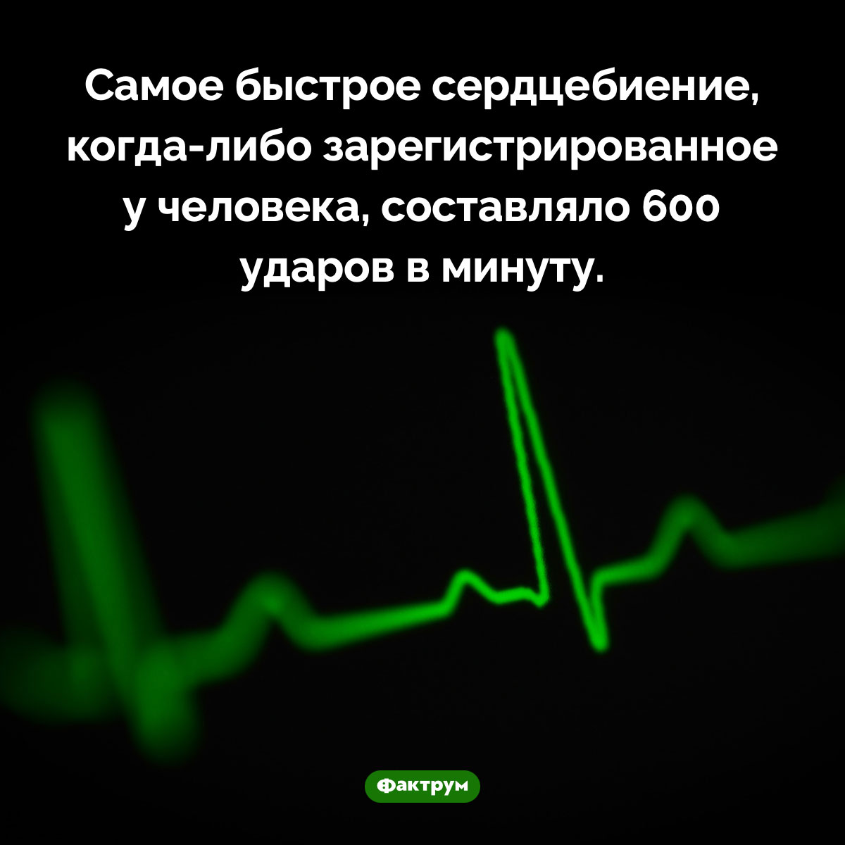 Самое быстрое сердцебиение. Самое быстрое сердцебиение, <nobr>когда-либо</nobr> зарегистрированное у человека, составляло 600 ударов в минуту.