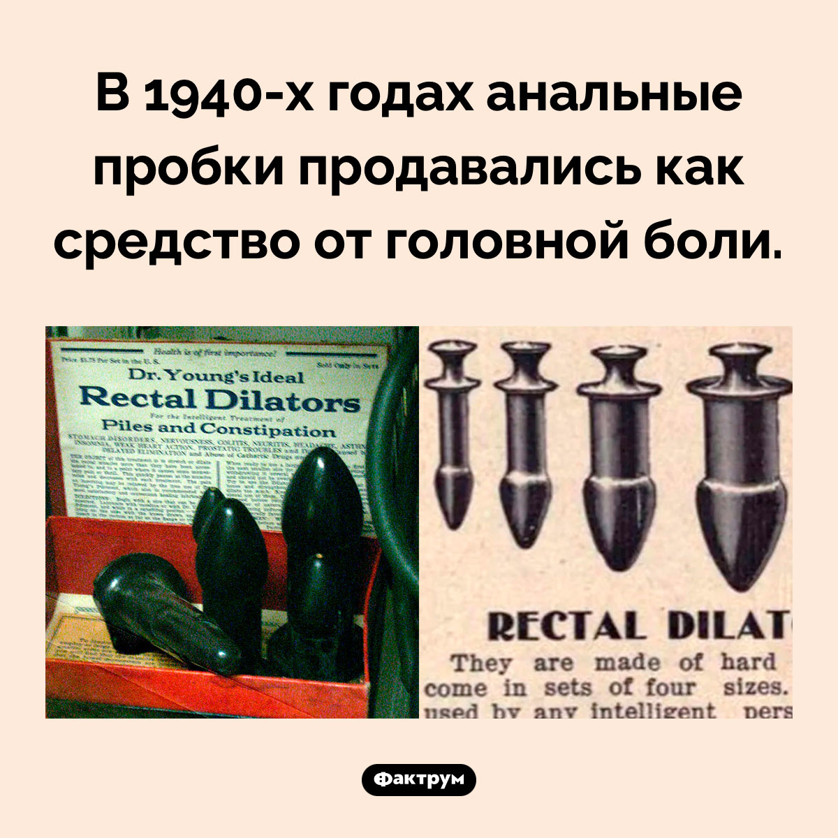 Анальные пробки от головной боли. В 1940-х годах анальные пробки продавались как средство от головной боли.