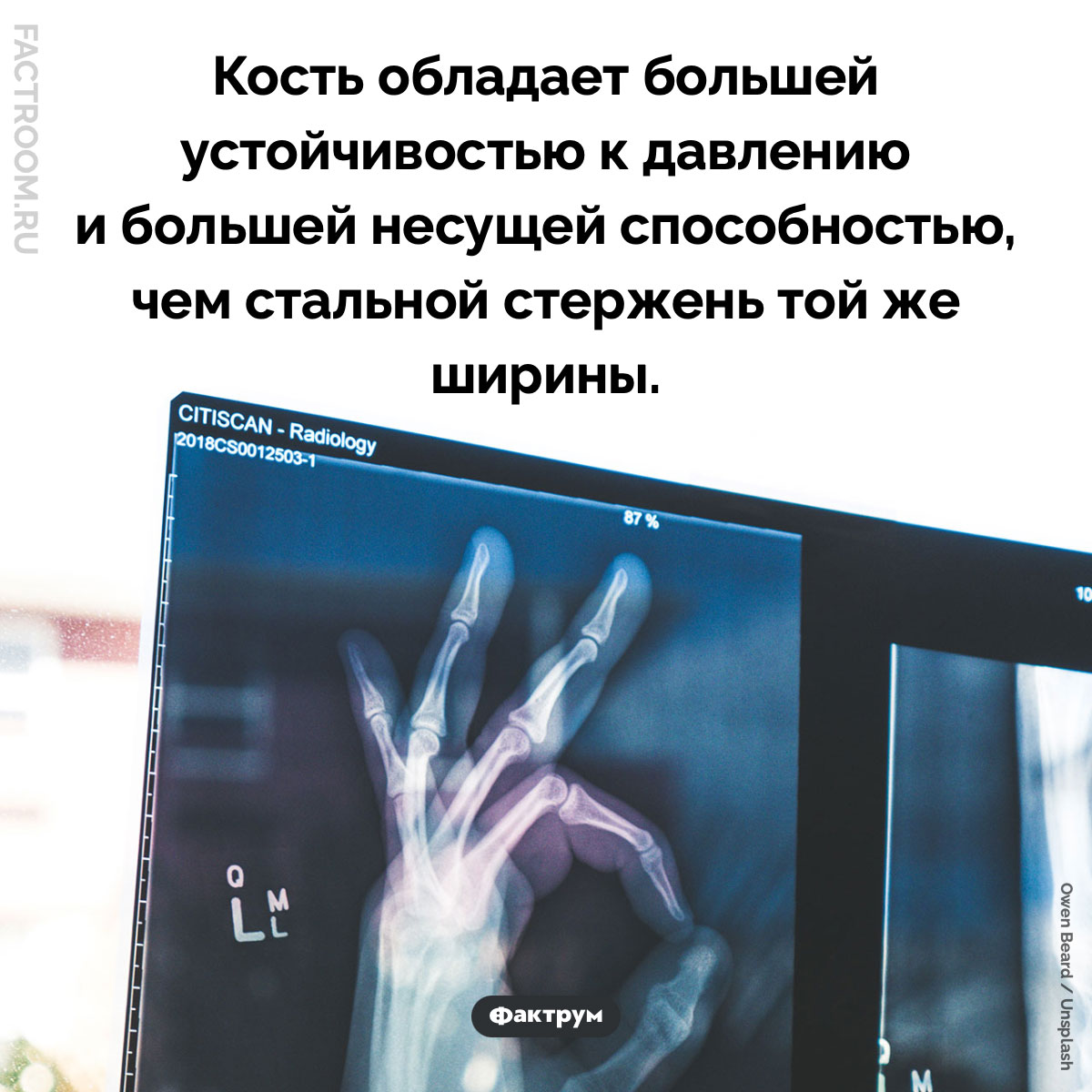 Кости прочнее стали. Кость обладает большей устойчивостью к давлению и большей несущей способностью, чем стальной стержень той же ширины.