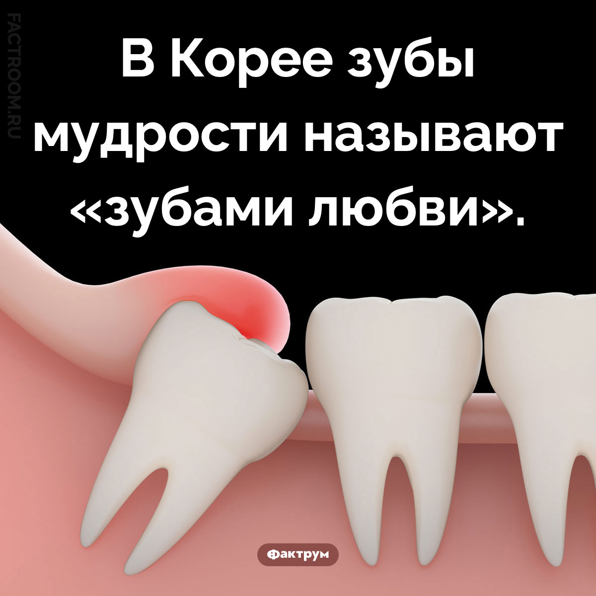 Корейские зубы мудрости. В Корее зубы мудрости называют «зубами любви».
